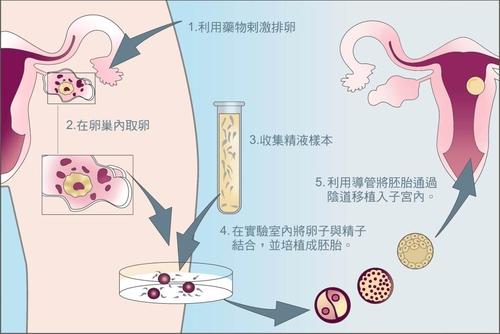 上海交通大学附属第一人民医院的第三代试管婴儿成功率高