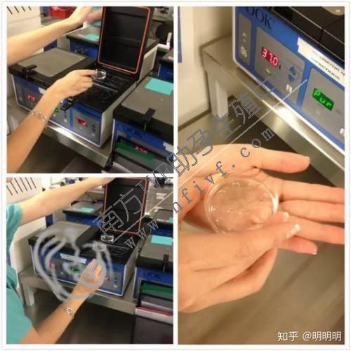 上海合法三代试管婴儿包成功-为什么在上海做试管婴儿要进行囊胚移植？
